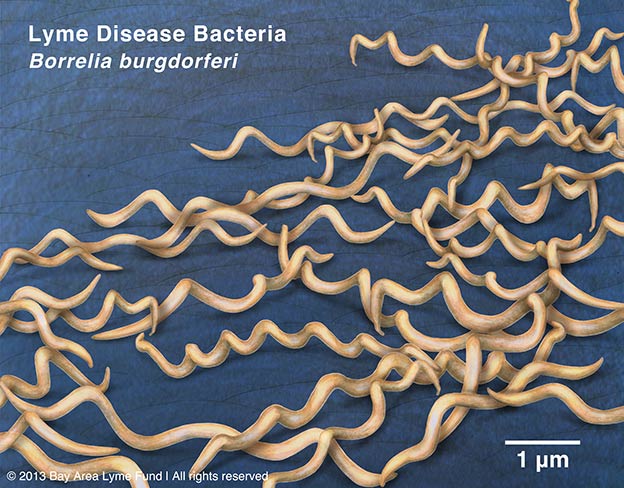 Borrelia burgdorferi