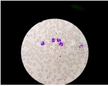 Babesia infecting red blood cells