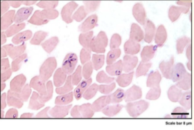 micrograph of the intracellular development of cultured B. duncani in hamster RBCs in a Giemsa-stained smear prepared at 3 days post-inoculation