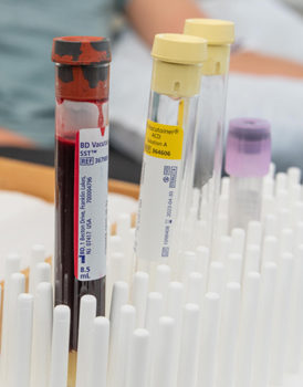 Lyme Disease Biobank blood vials