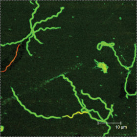 Borrelia burgodorferi