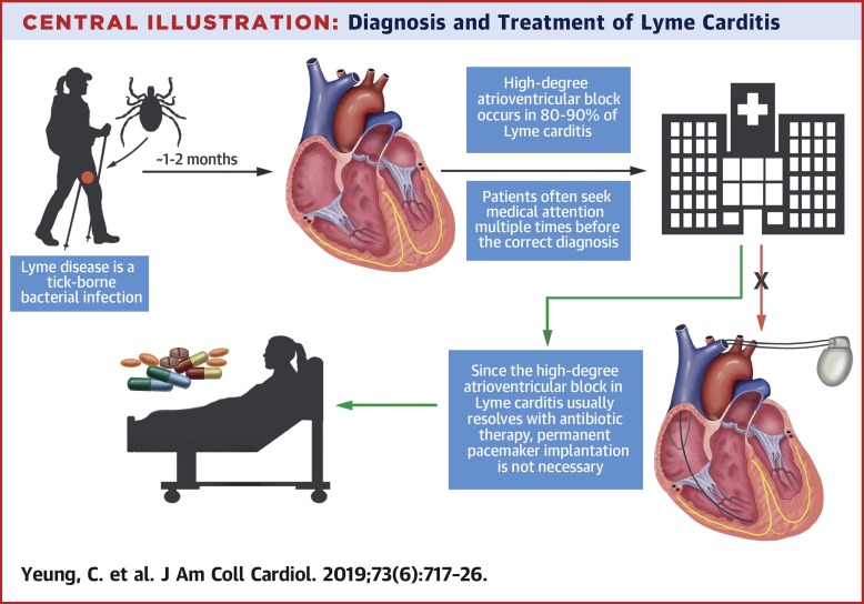 Infographic by Adrian Baranchuk, MD