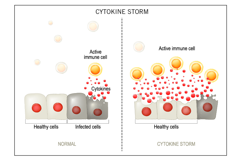 Cytokine Storm