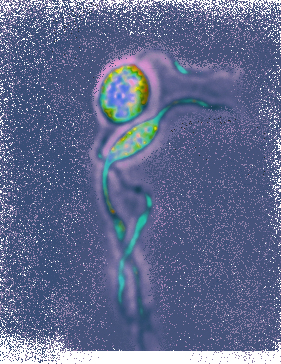 Dancing Borrelia, Mikki Tal, PhD