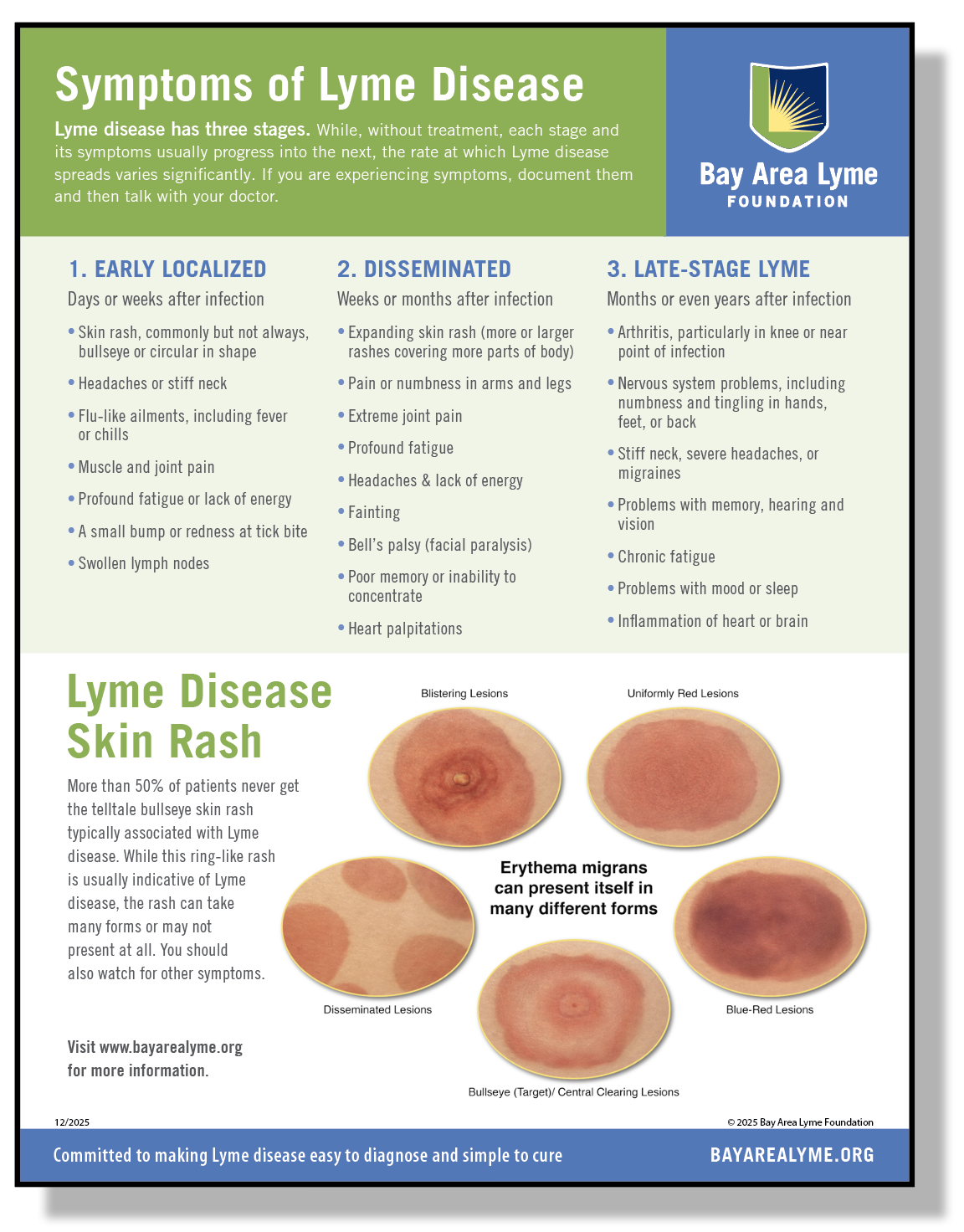 Lyme Disease Symptoms